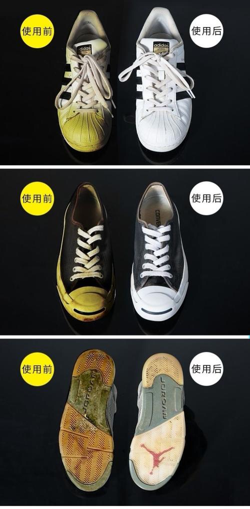 鞋子前沿黑怎么变白(鞋子前沿黑怎么变白色)-第1张图片-安保之家 鞋子前沿黑怎么变白(鞋子前沿黑怎么变白色)-第1张图片-安保之家