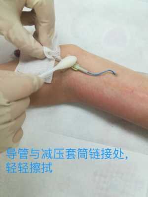picc维护一般镇上医院能做吗,plcc管换药视频-第2张图片-安保之家 picc维护一般镇上医院能做吗,plcc管换药视频-第2张图片-安保之家